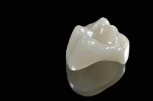 Dental Crowns In Durham, NC