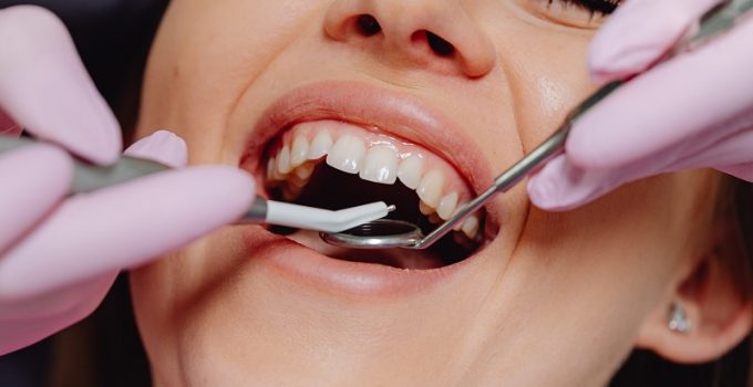 The Importance of Gum Health