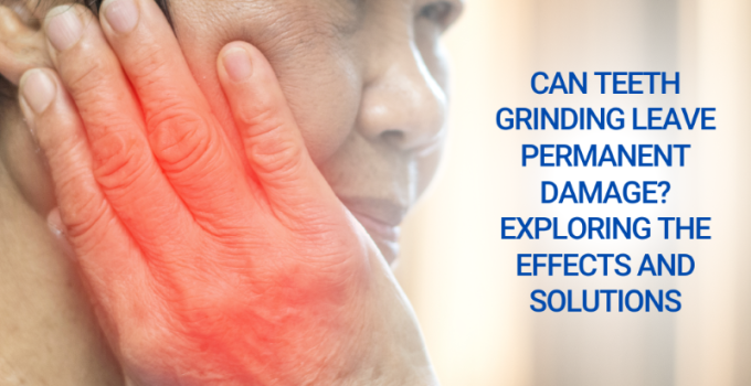 Can Teeth Grinding Leave Permanent Damage Exploring the Effects and Solutions